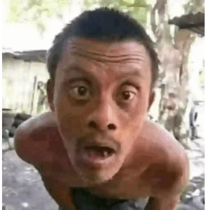 Surprised Expression (2)