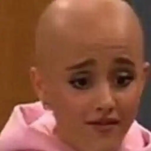 Awkward bald look