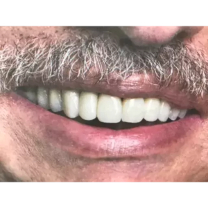 Slightly Suspicious Smile