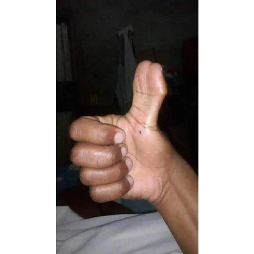 Thumbs Up Gesture