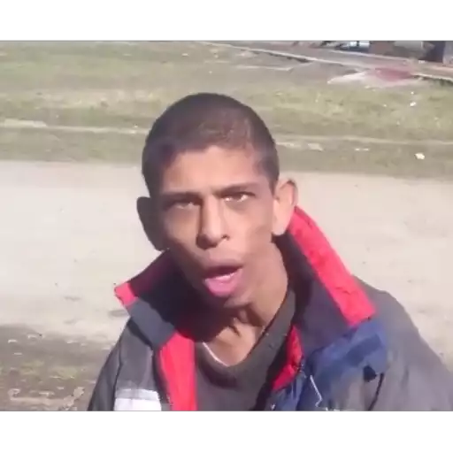 Surprised Reaction #3