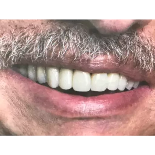Slightly Suspicious Smile